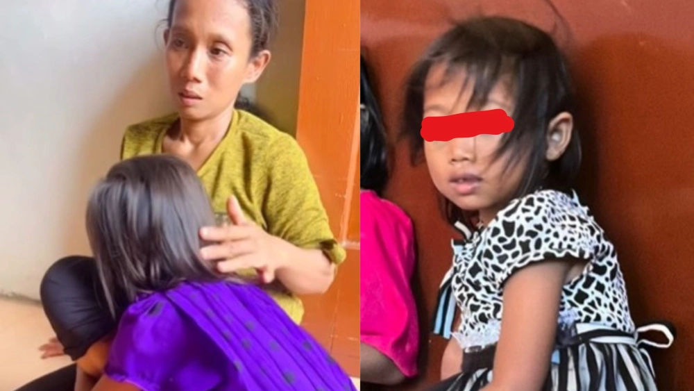 Bocah SD di Palembang alami dugaan pemukulan. [instagram @virasoniaaaa]